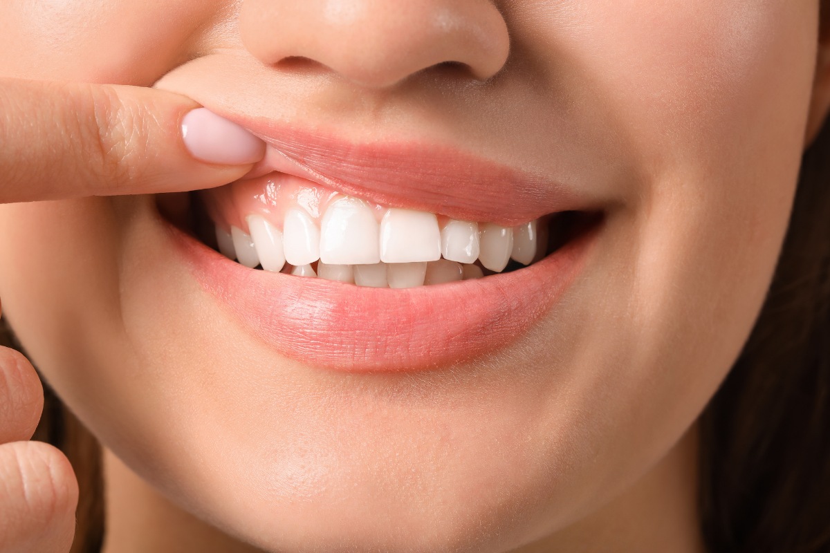 Signs Your Gums Need Help Signs Your Gums Need Help