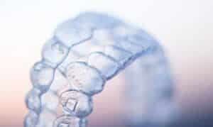 Invisalign Clear Aligners - Cosmetic Dentist in Scottsdale AZ - Kind Family Dentistry