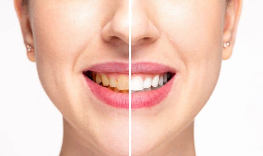 Cosmetic dentist in Scottsdale - Kind Family Dentistry Cosmetic dentist in Scottsdale - Kind Family Dentistry