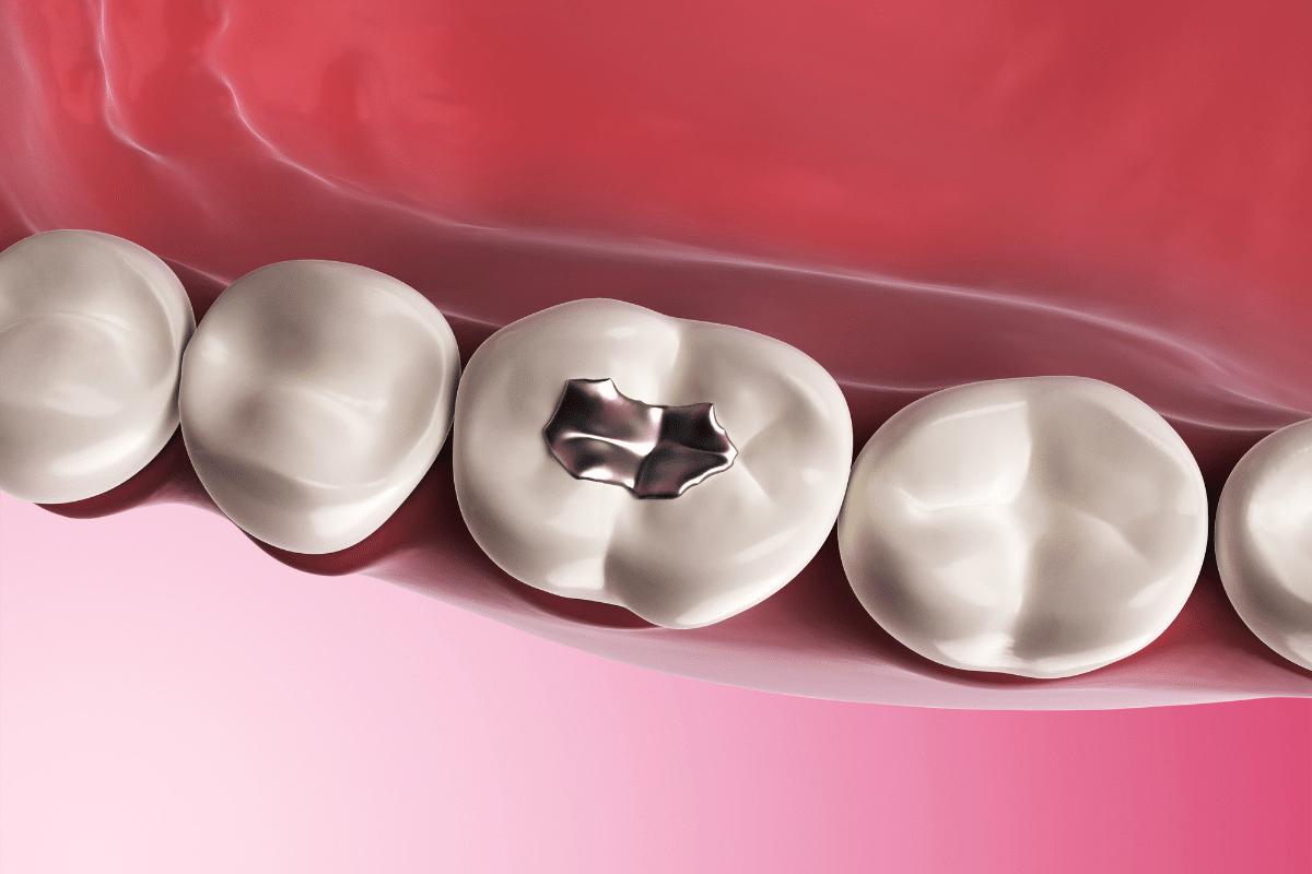 Your Trusted Solution for Dental Fillings in Scottsdale Your Trusted Solution for Dental Fillings in Scottsdale
