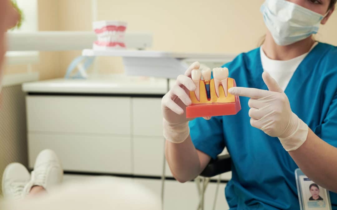 How To Protect Your Sensitive Teeth After Dental Implants?